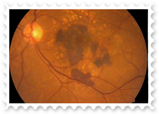 Medical Retina